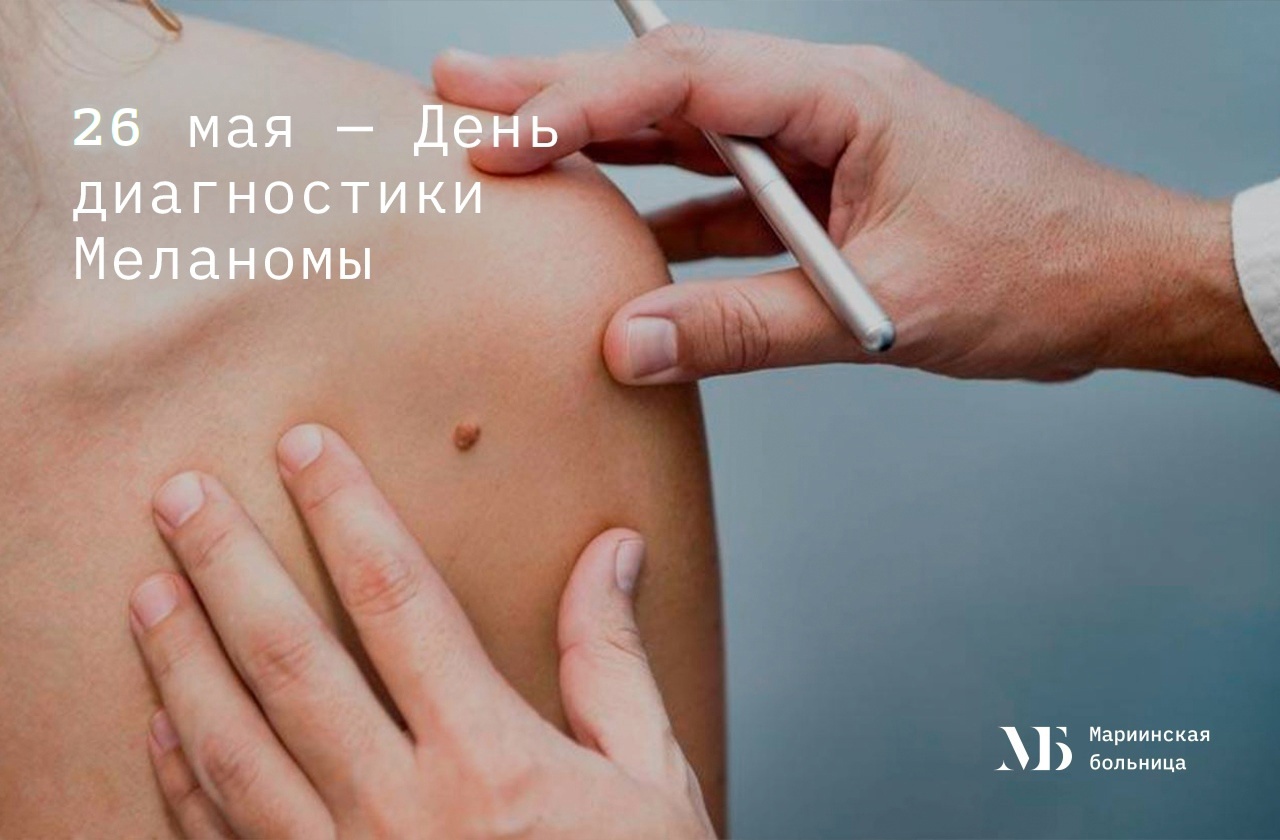 26 мая - День диагностики меланомы в Мариинской больнице